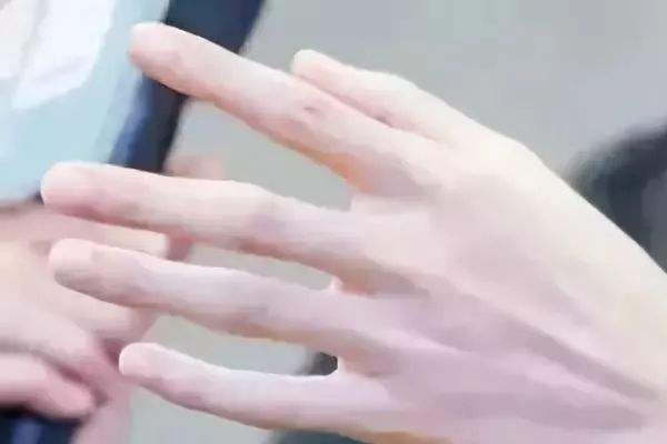 冬季如何治療皮膚干裂?五個(gè)方法有效解決 冬季如何治療皮膚干裂?五個(gè)方法有效解決