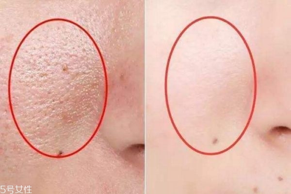 皮膚細(xì)膩零毛孔，教你三招搞定