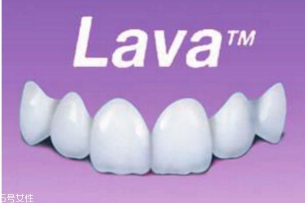 牙齒美容冠可以保持多久 影響因素不同 牙齒美容冠可以保持多久 影響因素不同