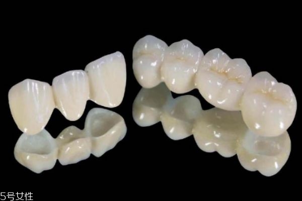 美容冠矯正牙齒好不好 美容冠矯正牙齒好處和壞處 美容冠矯正牙齒好不好 美容冠矯正牙齒好處和壞處