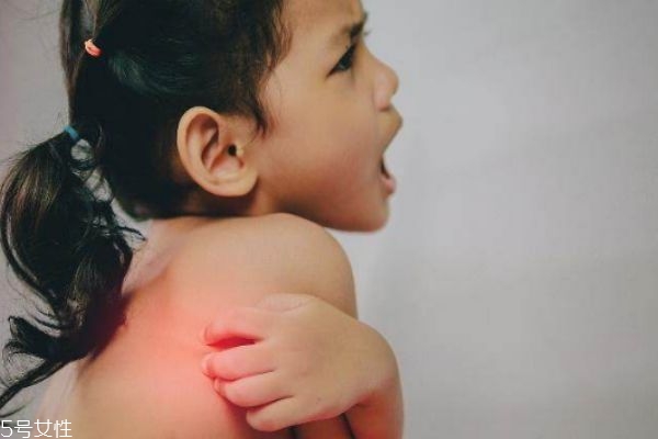 冬季瘙癢癥多久才會(huì)好 治療皮膚瘙癢的小偏方 冬季瘙癢癥多久才會(huì)好 治療皮膚瘙癢的小偏方