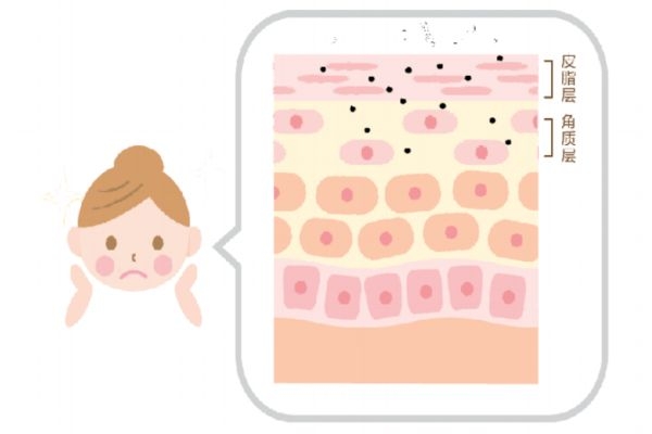 敏感肌膚怎么修復(fù)好 敏感皮膚需要注意哪些事項(xiàng) 敏感肌膚怎么修復(fù)好 敏感皮膚需要注意哪些事項(xiàng)