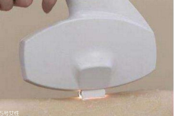 激光脫毛后還會長嗎 激光脫毛能堅(jiān)持幾年