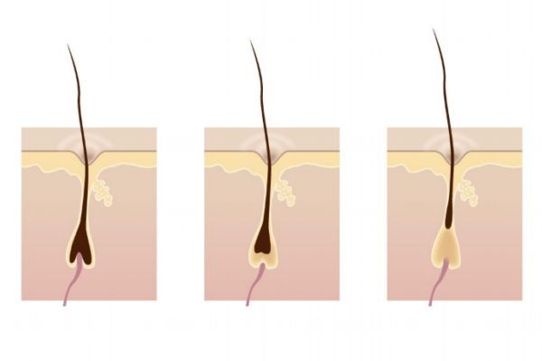 激光脫毛后還會長嗎 激光脫毛能堅(jiān)持幾年