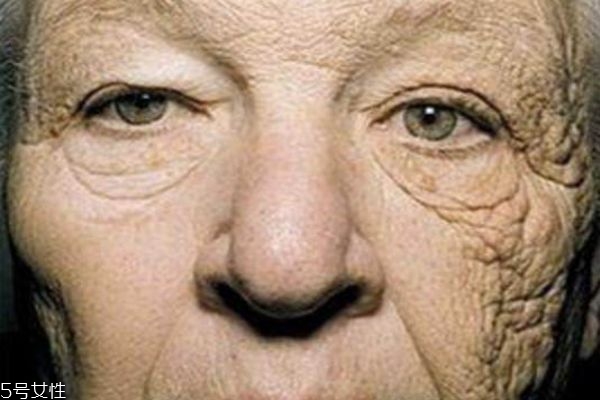 每天堅(jiān)持用防曬的變化 防曬和不防曬真人對比