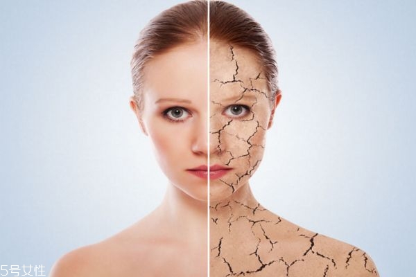 異位性皮炎怎么治療 保養(yǎng)預防是關鍵 異位性皮炎怎么治療 保養(yǎng)預防是關鍵