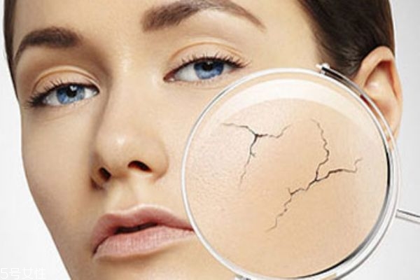 怎么修復皮膚屏障 換季過敏的原因 怎么修復皮膚屏障 換季過敏的原因