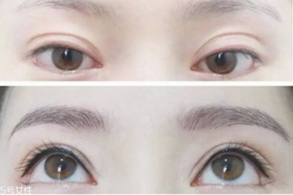 紋美瞳線多久恢復 美瞳線效果 紋美瞳線多久恢復 美瞳線效果