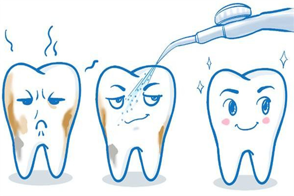 為什么洗牙有異物感 洗牙的誤區(qū) 為什么洗牙有異物感 洗牙的誤區(qū)