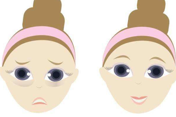 眼袋按摩可以消除嗎 眼袋按摩方法 眼袋按摩可以消除嗎 眼袋按摩方法