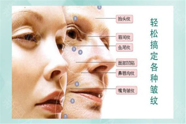 肉毒素有副作用嗎 怎么保養(yǎng)好 肉毒素有副作用嗎 怎么保養(yǎng)好