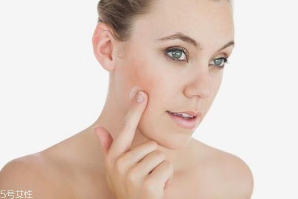 哪些護(hù)膚品不宜混搭使用 哪些成分絕對不能疊加 哪些護(hù)膚品不宜混搭使用 哪些成分絕對不能疊加