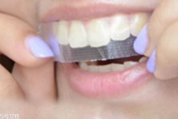 牙貼會損壞牙齒嗎 會有一定的傷害 牙貼會損壞牙齒嗎 會有一定的傷害