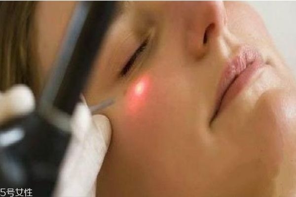 什么人適合做皮秒 皮秒祛斑的效果 什么人適合做皮秒 皮秒祛斑的效果