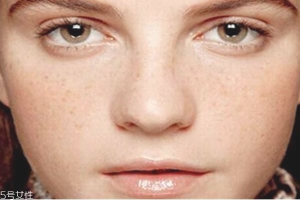 大蒜祛斑真的有用嗎 大蒜祛斑的準(zhǔn)確步驟 大蒜祛斑真的有用嗎 大蒜祛斑的準(zhǔn)確步驟