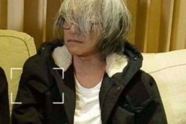 白頭發(fā)可以變黑嗎 頭發(fā)變黑的方法 白頭發(fā)可以變黑嗎 頭發(fā)變黑的方法