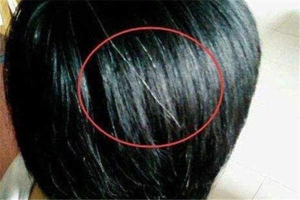 白頭發(fā)可以變黑嗎 頭發(fā)變黑的方法 白頭發(fā)可以變黑嗎 頭發(fā)變黑的方法