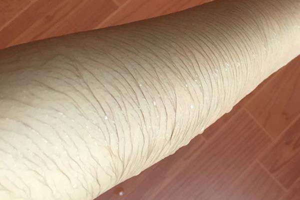 體毛太多怎么去除 體毛多的去除方法 體毛太多怎么去除 體毛多的去除方法