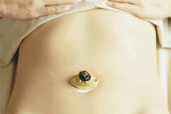 艾灸減肥會(huì)反彈嗎 保持健康生活習(xí)慣 艾灸減肥會(huì)反彈嗎 保持健康生活習(xí)慣