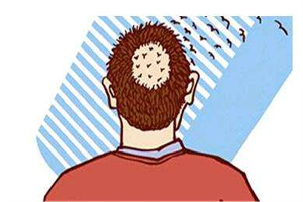 植發(fā)多少錢 植發(fā)好嗎 植發(fā)多少錢 植發(fā)好嗎