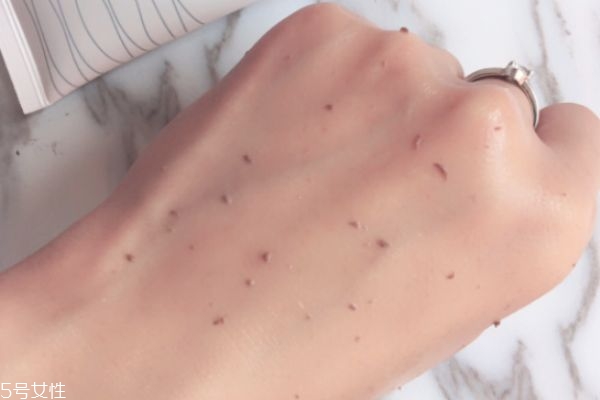 臉上起皮可以去角質(zhì)嗎 怎樣判斷臉上有角質(zhì)