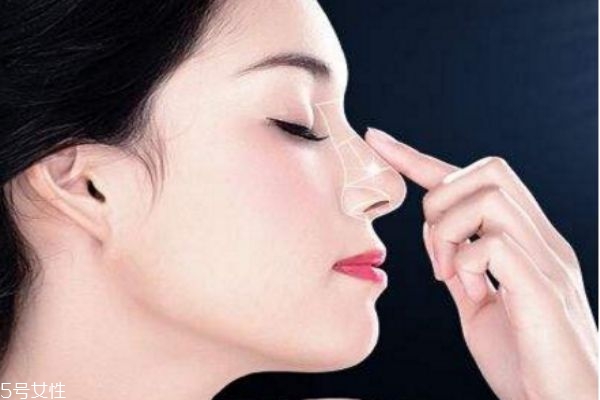 隆鼻修復(fù)安全嗎 鼻修復(fù)失敗案例 隆鼻修復(fù)安全嗎 鼻修復(fù)失敗案例