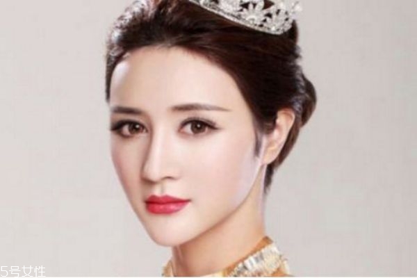 墊下巴多久可以恢復 墊下巴后多久可以吃飯 墊下巴多久可以恢復 墊下巴后多久可以吃飯