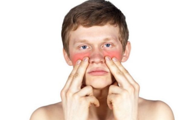 皮膚過敏色素沉著怎么辦 皮膚過敏緩解妙招 皮膚過敏色素沉著怎么辦 皮膚過敏緩解妙招