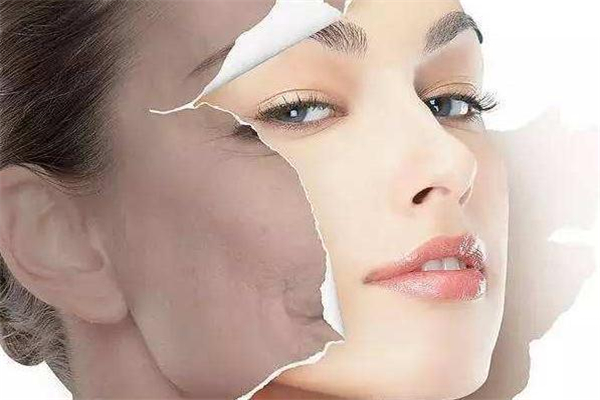 光子嫩膚掉痂后紅印怎么辦 光子嫩膚會(huì)留疤嗎