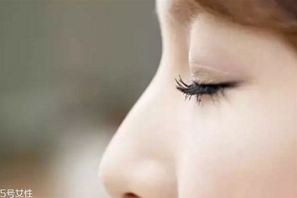 腫泡眼適合做什么雙眼皮 腫泡眼適不適合做雙眼皮 腫泡眼適合做什么雙眼皮 腫泡眼適不適合做雙眼皮