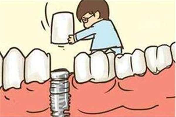 種植牙有什么風險 種植牙的風險大嗎 種植牙有什么風險 種植牙的風險大嗎