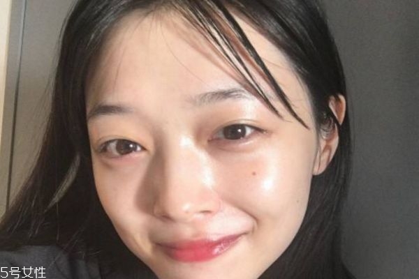 王者風范做幾次有效果 王者風范激光注意事項 王者風范做幾次有效果 王者風范激光注意事項