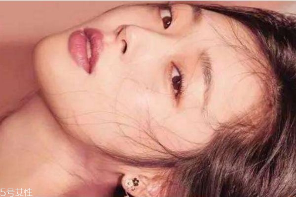 光子嫩膚反黑是怎么回事 光子嫩膚適合什么膚質(zhì) 光子嫩膚反黑是怎么回事 光子嫩膚適合什么膚質(zhì)