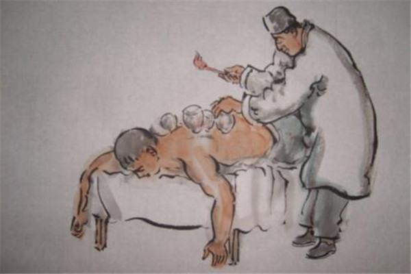 撥火罐后皮膚黑紫的原因是什么 拔火罐皮膚為什么會(huì)黑紫 撥火罐后皮膚黑紫的原因是什么 拔火罐皮膚為什么會(huì)黑紫