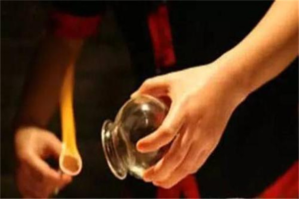 拔火罐多少錢一次 拔火罐怎么收費(fèi) 拔火罐多少錢一次 拔火罐怎么收費(fèi)