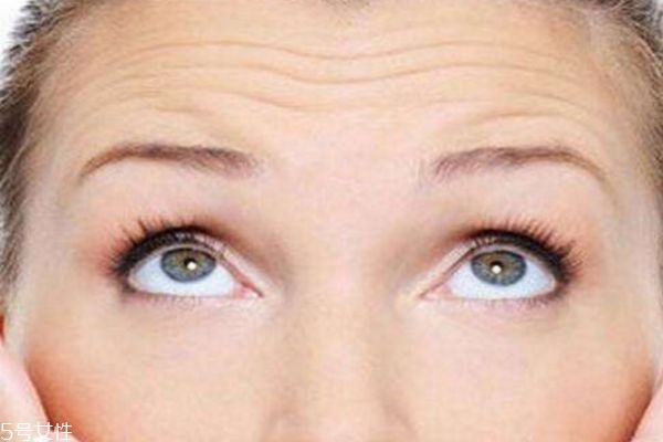 怎樣消除抬頭紋 去抬頭紋小妙招 怎樣消除抬頭紋 去抬頭紋小妙招