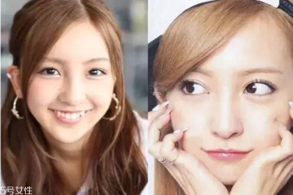 眼瞼下至術(shù)是什么 眼瞼下至術(shù)的手術(shù)原理 眼瞼下至術(shù)是什么 眼瞼下至術(shù)的手術(shù)原理