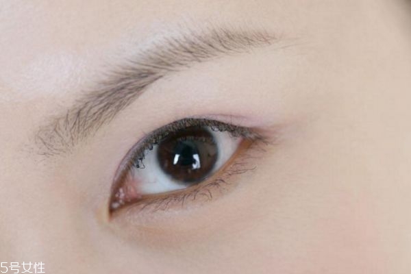 上瞼下垂手術(shù)能保幾年 上瞼提肌縮短術(shù)后遺癥 上瞼下垂手術(shù)能保幾年 上瞼提肌縮短術(shù)后遺癥