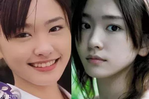 眼瞼下至術(shù)是什么 眼瞼下至術(shù)的手術(shù)原理 眼瞼下至術(shù)是什么 眼瞼下至術(shù)的手術(shù)原理