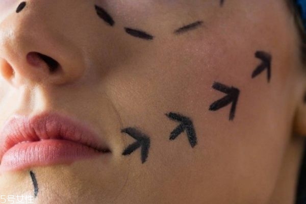 水光針的美膚作用有哪些 水光針的九大功效 水光針的美膚作用有哪些 水光針的九大功效