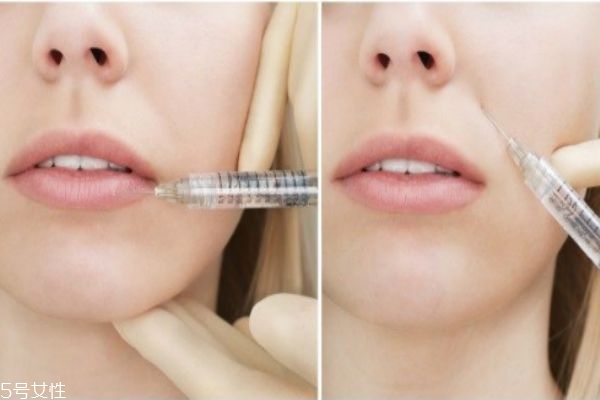 水光針的美膚作用有哪些 水光針的九大功效 水光針的美膚作用有哪些 水光針的九大功效