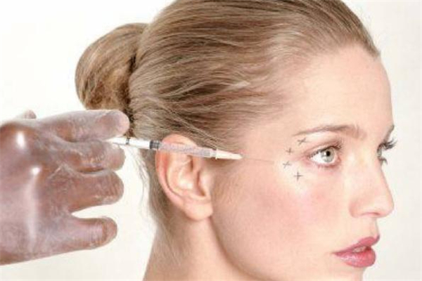 愛貝芙是什么 愛貝芙是玻尿酸嗎 愛貝芙是什么 愛貝芙是玻尿酸嗎