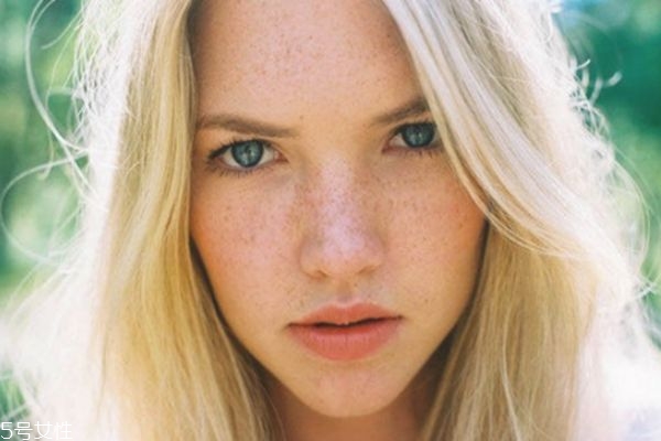 臉上有好多斑怎樣祛斑 激光祛斑才夠徹底 臉上有好多斑怎樣祛斑 激光祛斑才夠徹底