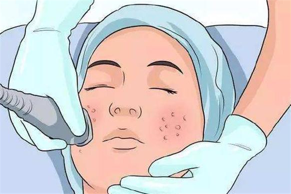 做超微小氣泡多久見效 超微小氣泡幾天有效果 做超微小氣泡多久見效 超微小氣泡幾天有效果