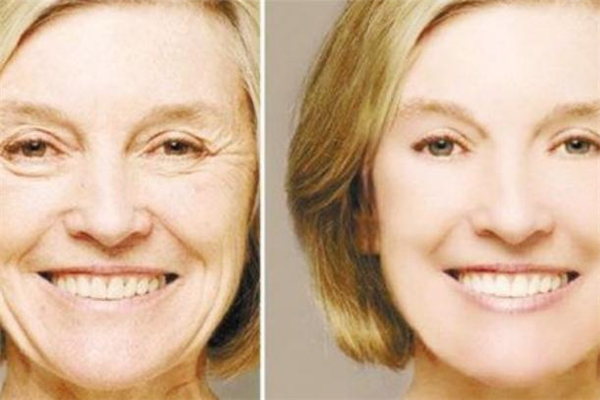 注射羊胎素有副作用嗎 打羊胎素有風(fēng)險(xiǎn)嗎 注射羊胎素有副作用嗎 打羊胎素有風(fēng)險(xiǎn)嗎