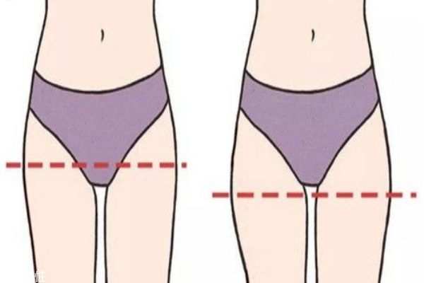 什么是假胯寬 假胯寬是肉突出還是骨頭突出 什么是假胯寬 假胯寬是肉突出還是骨頭突出