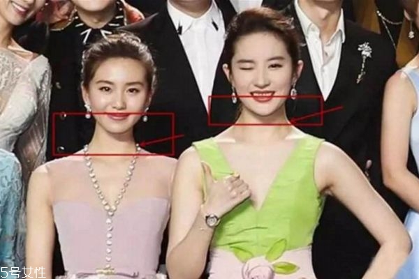 斜方肌是什么 斜方肌是怎么造成的 斜方肌是什么 斜方肌是怎么造成的