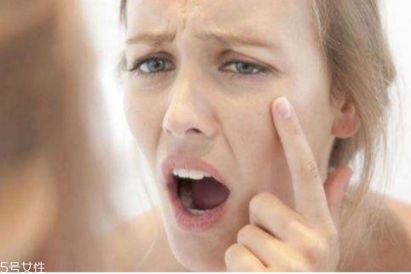 電波拉皮術(shù)疼嗎 電波拉皮的除皺效果如何 電波拉皮術(shù)疼嗎 電波拉皮的除皺效果如何