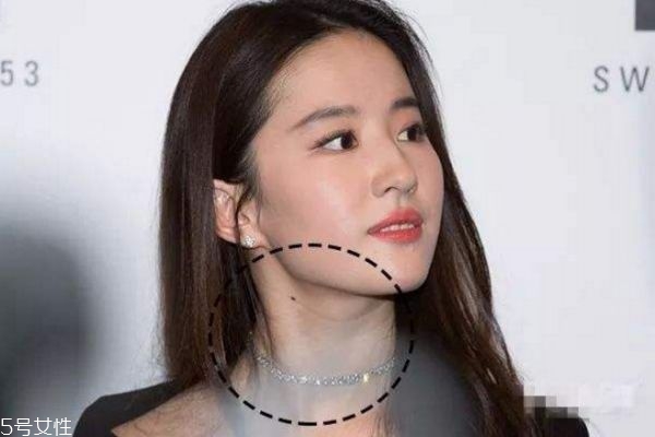 頸紋和胖有關系嗎 瘦了是不是頸紋就會沒 頸紋和胖有關系嗎 瘦了是不是頸紋就會沒