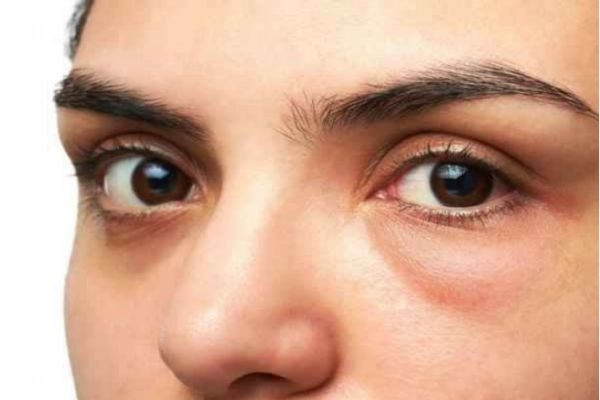 眼部可以涂防曬嗎 防曬霜能抹在眼部嗎 眼部可以涂防曬嗎 防曬霜能抹在眼部嗎